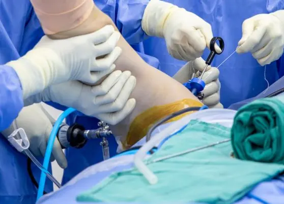 Shoulder Surgery